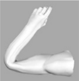 assets/collapsing_elbow.png